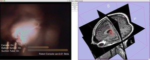 3D Slicer Based Surgical Robot Console System